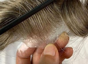 ساختار پروتز مو به شکل است