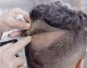 نحوه ساخت پروتز مو