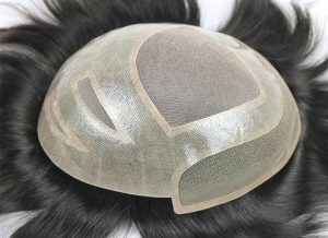 پروتز مو چیست