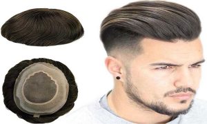 ساختار پروتز به چه شکل است